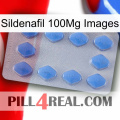 Sildenafil 100Mg Images 21